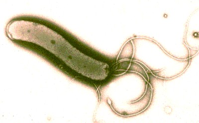 H_pylori.jpg